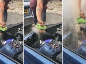 Teen Suffers Serious Burns On Removing Radiator Cap From Hot Car