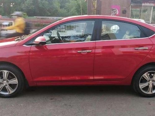 2017 Hyundai Verna 1.6 CRDi SX MT for sale in Surat 